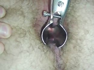 Anal speculum and prostate stimulator orgasm