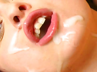 Teen receives amazing facial